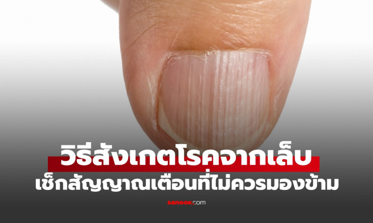 เล็บผิดรูป! สัญญาณเตือนร้ายจากร่างกายที่คุณมองข้ามไม่ได้ ตรวจด่วนก่อนสายเกิน!