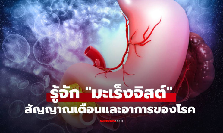 รู้จัก โรคมะเร็งจิสต์ (GIST) ภัยเงียบในระบบทางเดินอาหาร เกิดจากอะไร? สัญญาณเตือนและอาการที่ควรเฝ้าระ