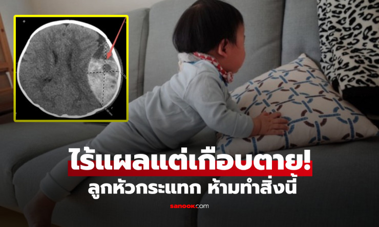 อุทาหรณ์สะเทือนใจ! ทารก 6 เดือนตกโซฟา ไม่มีแผลให้เห็น แต่เกือบตายเพราะสิ่งที่พ่อแม่มักมองข้าม