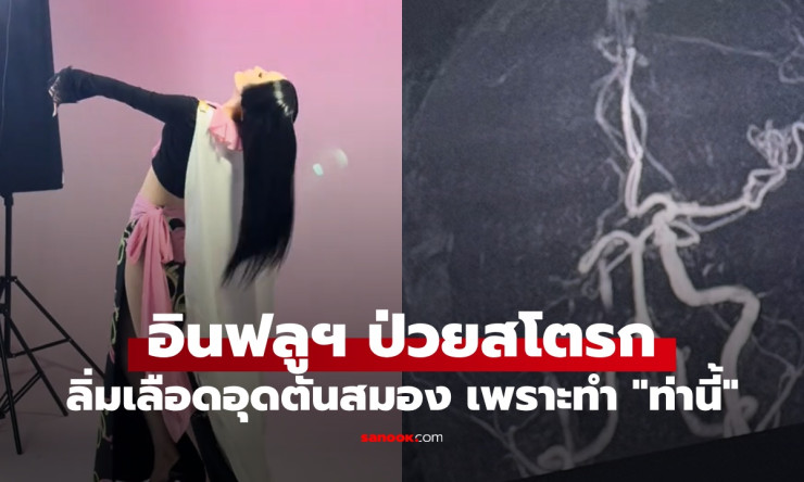 อินฟลูฯ สาววัย 32 ป่วยสโตรก ลิ่มเลือดอุดตันสมอง หลังถ่ายคอนเทนต์ทำท่านี้
