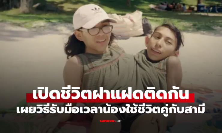 ช็อกสุดๆ! ฝาแฝดติดกัน คนนึงมีสามี อีกคนนั่งดูเฉยๆ? ชีวิตจริงโหดขนาดไหน