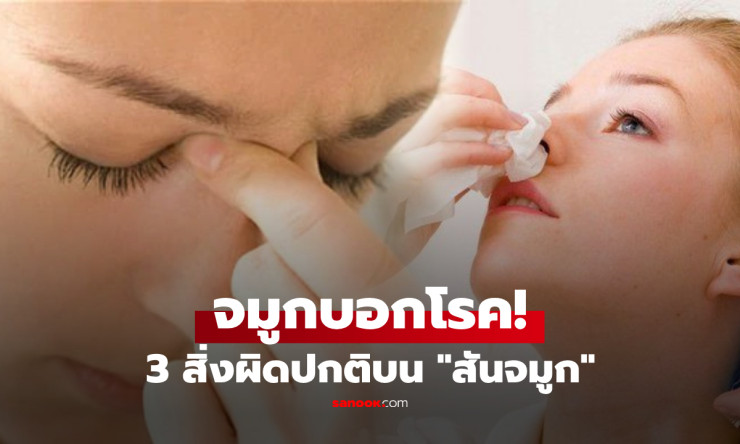 ส่องกระจกแล้วตกใจ! 3 จุดผิดปกติบนสันจมูกที่อาจบอกได้มากกว่าความสวยงาม ทั้งภูมิแพ้เรื้อรัง กระดูกสันห