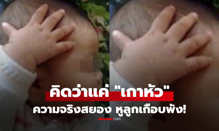 ลูกชาย 1 ขวบ เกาหัวบ่อยๆ พ่อแม่คิดว่าแค่เล่น สุดท้ายรู้ความจริงสยอง เกือบเสียการได้ยิน!