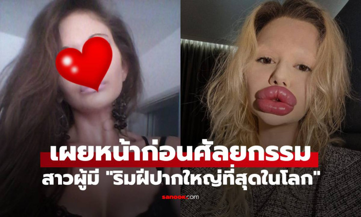 เผยโฉมหน้าก่อนศัลยกรรมของหญิงผู้มีริมฝีปากใหญ่ที่สุดในโลก แอนเดรีย อิวาโนวา